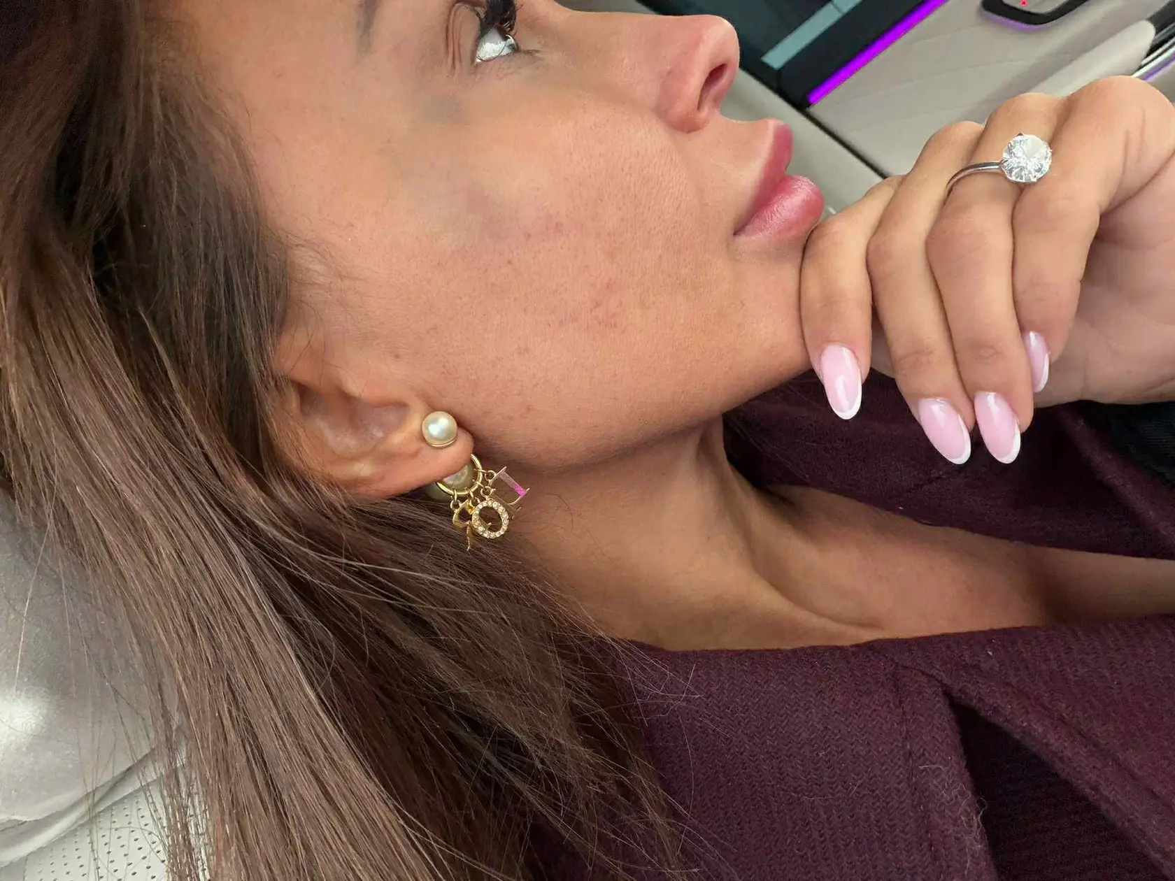 Jákliová arcán akkora zúzódás volt.